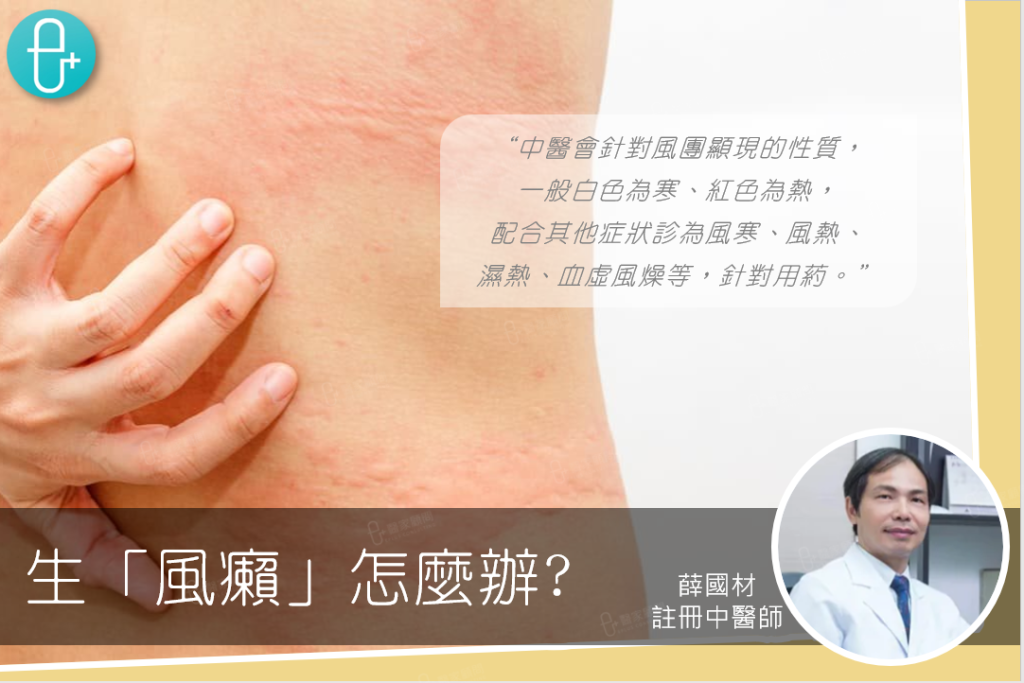 Eplusmed blog cover_Chinese Medicine_風癩
