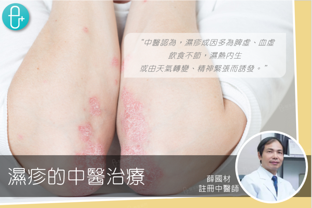 Eplusmed blog cover_Chinese Medicine_濕疹 eczema